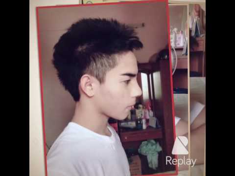 เสริมจมูกหมอบุญถิ่น4 (25 วัน)
