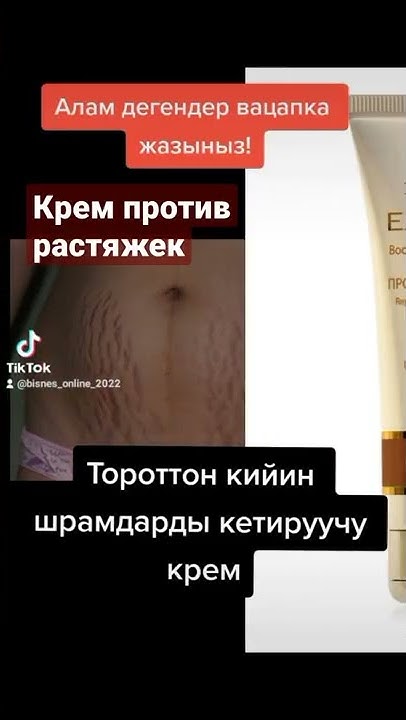 Крем против растяжек,для женщин во время беременности, для профилактики ...