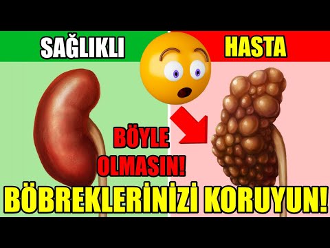 Video: “Köpeğe Dikkat Edin” İşaretleri: Önlem Veya Sorumluluk?