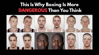 Brain Damage In Boxing The Truth Nobody Talks About