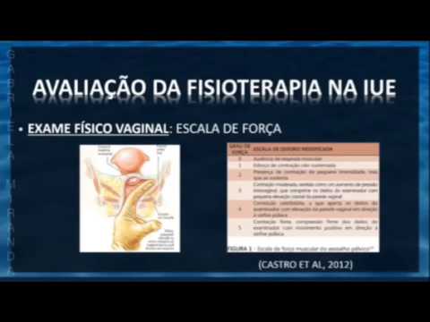 Slides com referência: Incontinência urinária de esforço. Avaliação e tratamento Fisioterapia video phone beyonce mp3