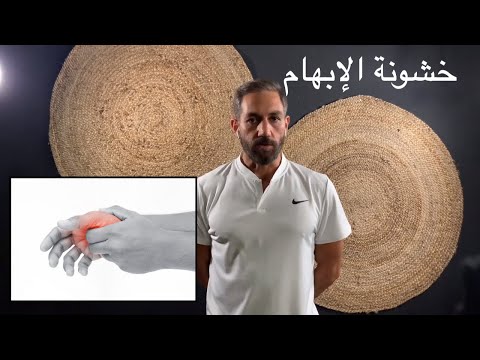 ٣٩ - آلام الابهام - خشونة مفصل الإبهام -  تمرين واحد كافي لأنهاء المعاناة -  rhizarthrose