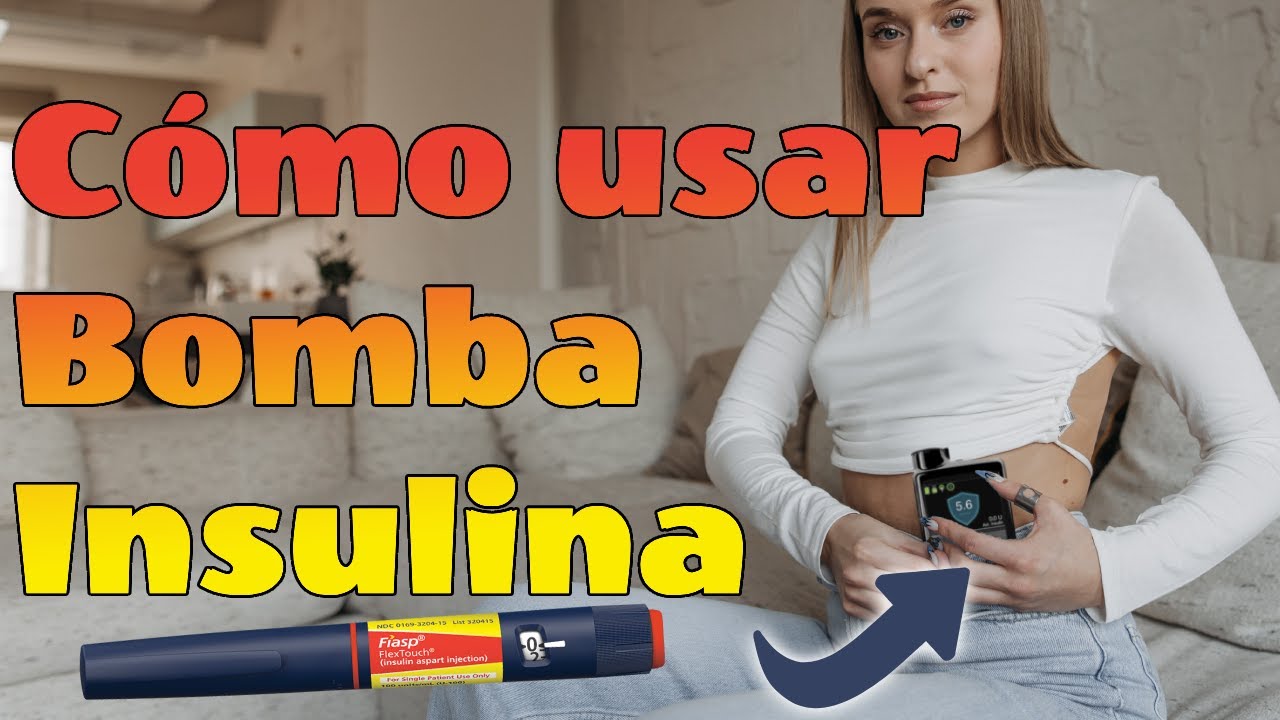 Aprende cómo ponerse una BOMBA de INSULINA. Diabétes