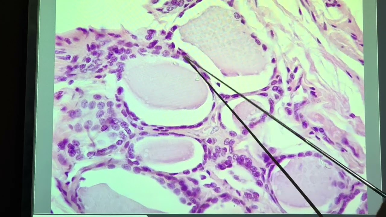 BIOL 105 Thyroid Gland Slide