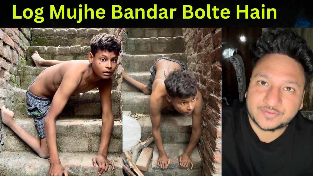 Печаль ребенка-инвалида 🥺 Люди называют его обезьяной @sandeepbhatt