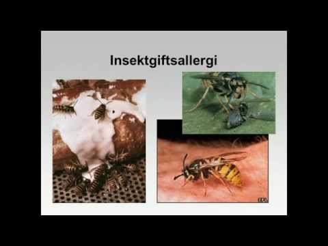 Video: Allergisk Hoste: Symptomer Og Behandling Hos Voksne, Anmeldelser