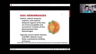 Challenging and Controversial Topics in Glaucoma 2020