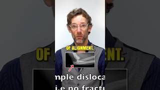 Two Types Of Elbow Dislocations