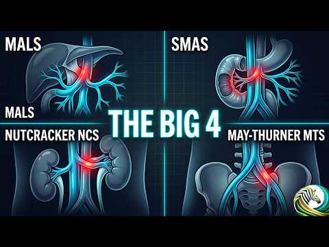 Vascular Compression Syndromes in EDS & HSD: MALS, NCS, SMAS & MTS Explained