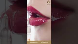 Lip Micropigmentation | How to Treat Dark Lips | Get Soft Red Lips | Wee Aesthetics #shorts screenshot 4