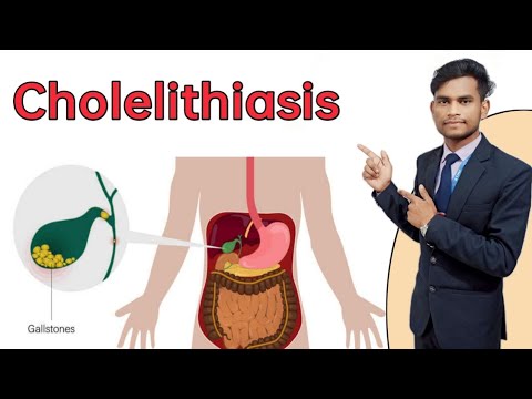 Cholelithiasis Hindi Explanation || Etiology , Sign and symptoms