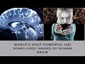 Worlds most powerful mri scans first images of human brain