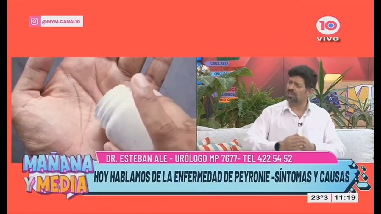 Enfermedad de Peyronie, sus síntomas y causas | Dr Esteban Ale - Médico Urologo
