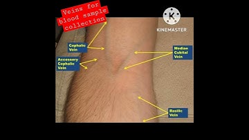 most suitable veins for blood sample collection🥏🥏