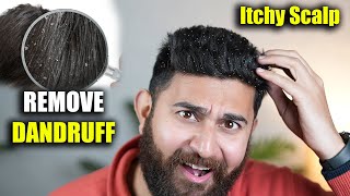 6 Tips To Remove Dandruff Forever | GET RID OF Dandruff & Itchy Scalp In Winter | DSBOSSKO
