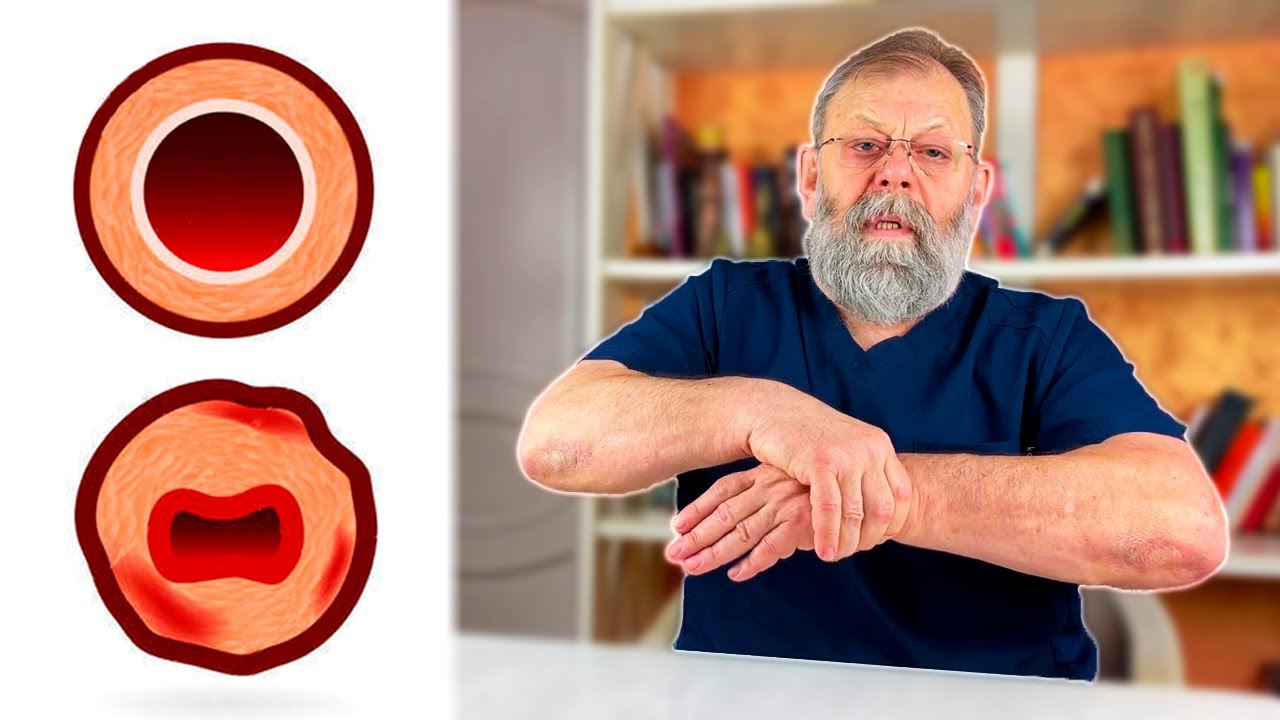 ЛУЧШЕЕ УПРАЖНЕНИЕ ДЛЯ СОСУДОВ ЗДЕСЬ! - YouTube