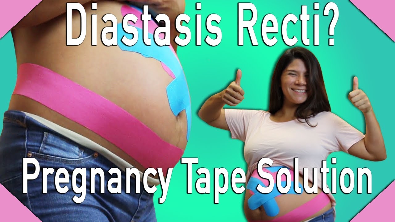 Pregnancy Tape - Helps with Pelvic, Belly and Back Support