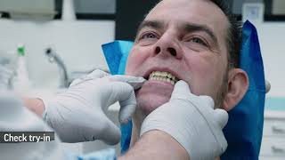 NextDent Workflow Copy Dentures