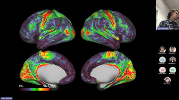 Logan Williams - a tutorial on getting the best from connectome workbench and BALSA