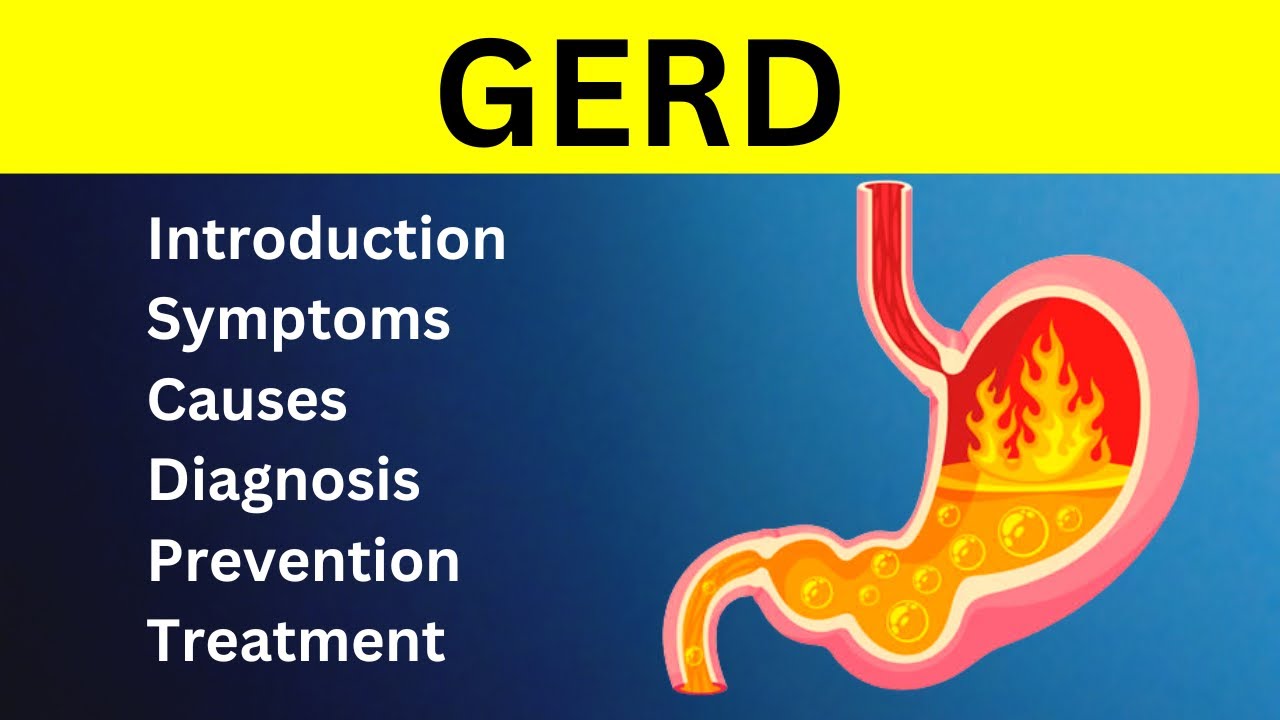 Gastroesophageal Reflux Disease || What is GERD || Gerd Treatment
