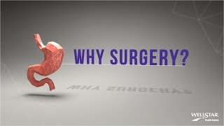 Wellstar Bariatric Surgery - Why Surgery?