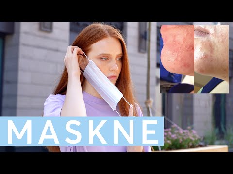 How to Treat & Prevent Face Mask Acne - 'Maskne'