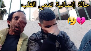 حالة إنسانية تدمي القلب الصديق يطلب المساعدة من المحسنين 