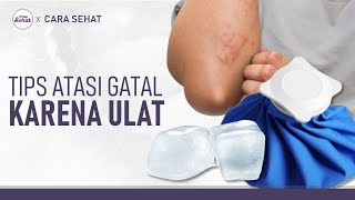 Jangan Digaruk! Ini Cara Mengatasi Gatal Akibat Ulat Bulu | Hidup Sehat tvOne