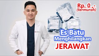 cara menghilangkan jerawat batu dan bekasnya