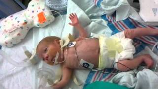 26 week preemie, 8 weeks later