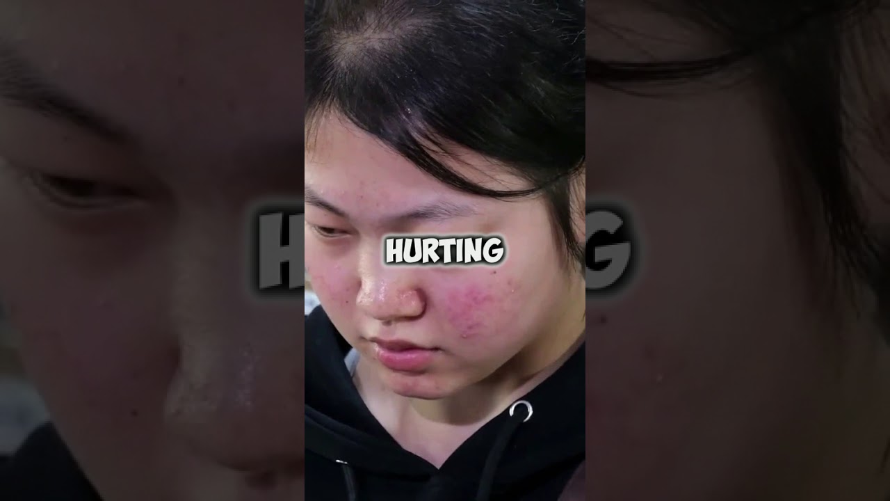 Fractured Spine and No Care from My Husband, Was I Wrong for Calling Him an AH 