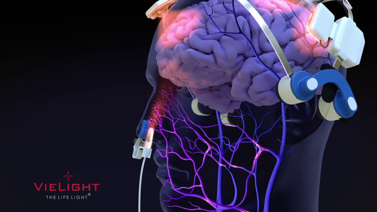 Vielight Neuro Alpha Gamma Animation YouTube