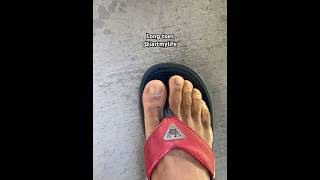 When You Got the Longest Toes on Earth! 😭 #Shorts