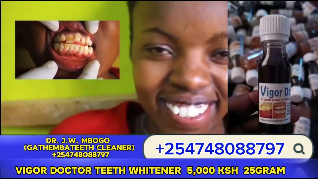 how-to-whiten-brown-teeth-instant-teeth-whitener-offer-5000ksh