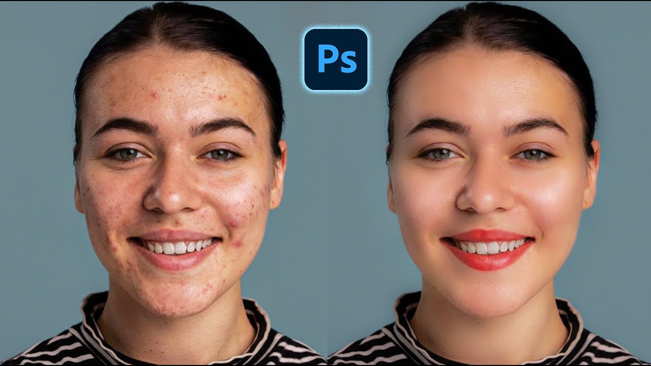Mastering Photoshop's Skin Correction | Skin Retouching in Photoshop | Photoshop Tutorials
