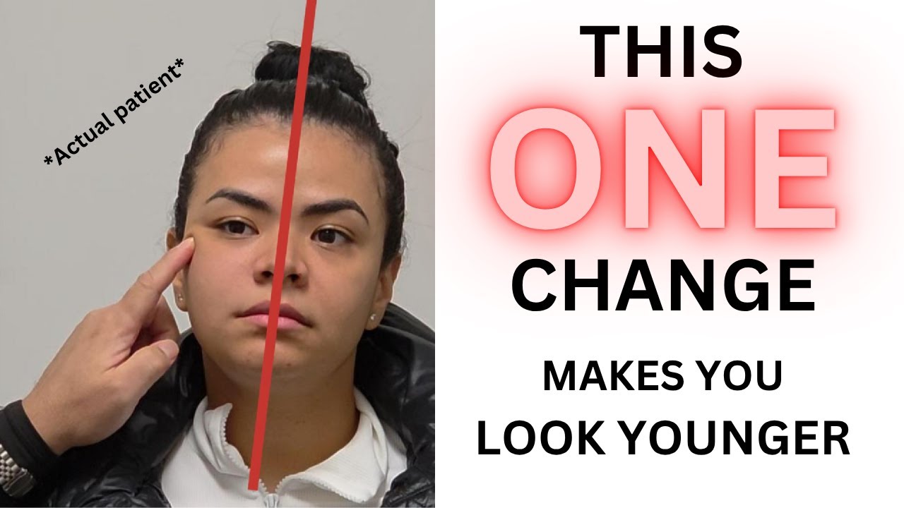 FULL Consultation LIVE Endolift & Thread Lift