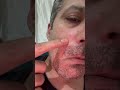 #waxing #ingrownhair #trending #hair #beard #remove #asmr #maazsafder #hairremoval #natural NK.0186