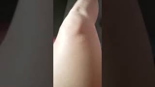 D. E. W. Attack Muscle Twitching Victim Of Organized Stalking Gang Stalking Torture Program