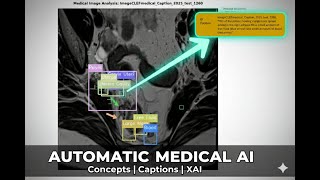 JJ VMed: AI System for Medical Image Captioning & Visual Explainability