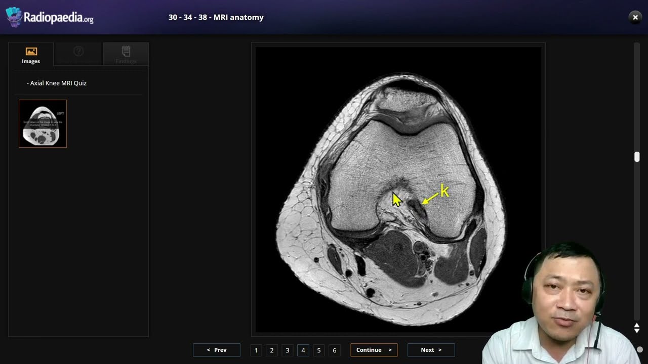 30- 2- MRI Knee Anatomy