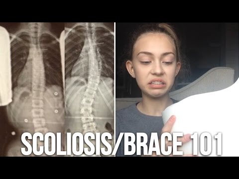 Youtube T Shirts For Scoliosis Brace