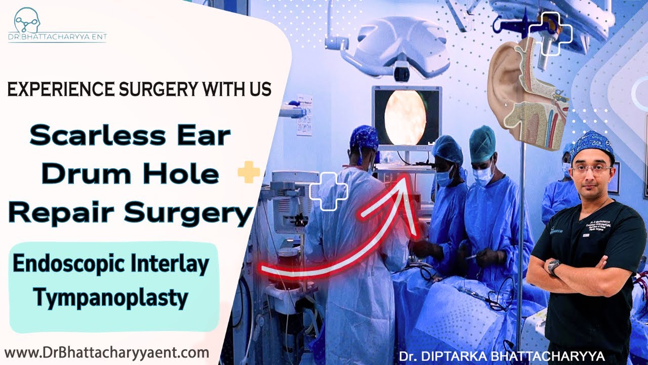 Endoscopic Ear Drum hole repair surgery (Tympanoplasty) : Experience ...