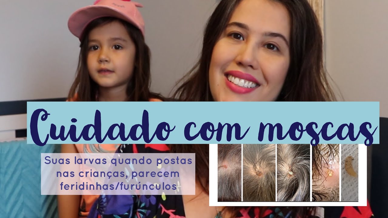 Cuidado com moscas no verão larvas/bernes em crianças, parecem feridas/furúnculos YouTube