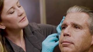 How Much Does Botox Cost? | Senara Health and Healing Center & Spa
