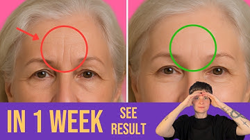 No Botox Needed: Fix FROWN LINES & FOREHEAD WRINKLES at Home