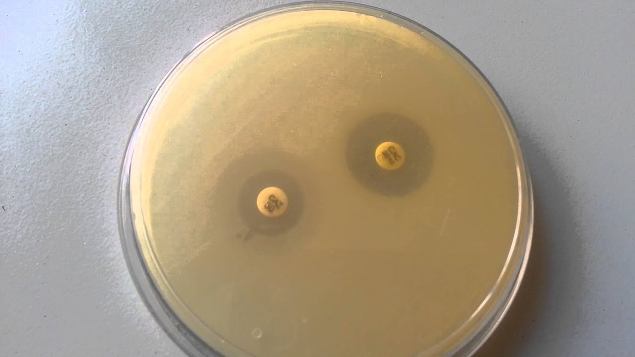 Extended spectrum beta lactamase ESBL detection YouTube