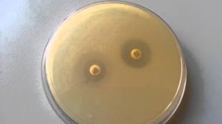 Extended spectrum beta lactamase| ESBL detection