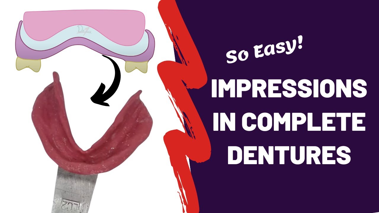 Theories of Impression Making in Complete Dentures