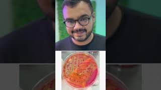 Urine culture: Escherichia coli, Pseudomonas, urinary tract infection and other practical tips