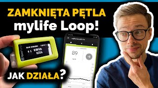 Poziom cukru we krwi kontrolowany automatycznie? | Pompa insulinowa Ypsopump i Dexcom G6 |Nie słodzę screenshot 1
